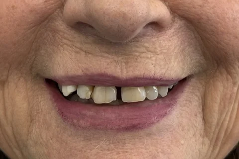 PRIMA